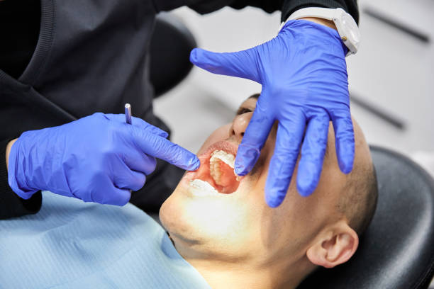 Best Emergency Treatment for Dental Infections or Abscesses in Stonecrest, GA