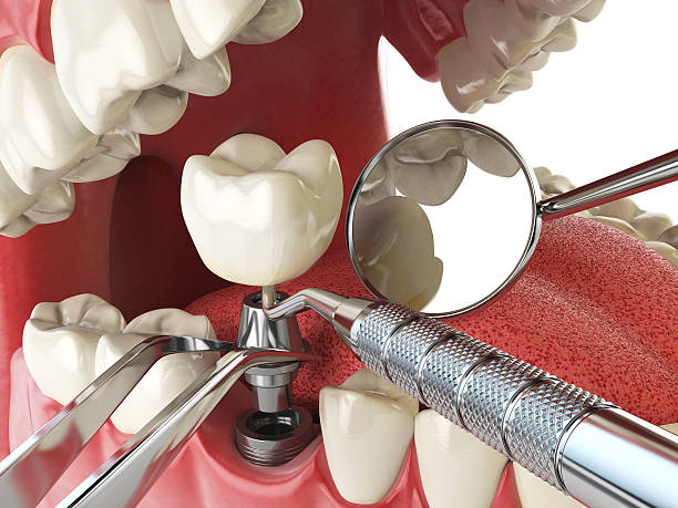 Best Emergency Gum Treatment in Stonecrest, GA